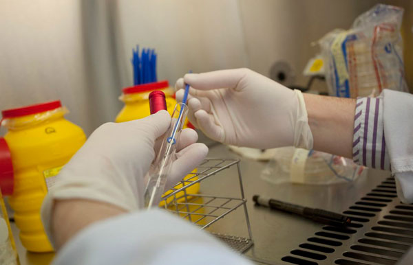 Sanidad registra cuatro casos confirmados y uno en estudio de viruela del mono desde ayer